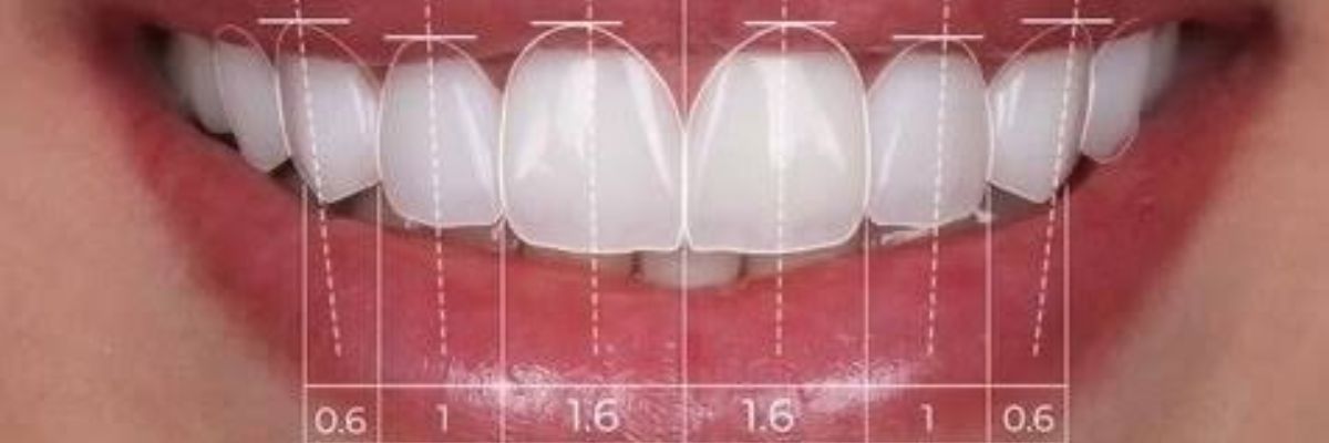 Smile design at OV Dental Studio